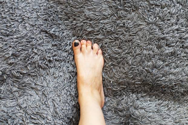 leg with bruise on toenail on gray carpet. hematoma under the nail