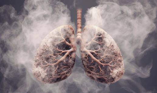 Simptomi i vrste raka pluća na koje morate obratiti pozornost