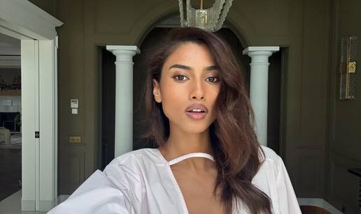 FOTO An&dstrok;eosko lice! Evo za&scaron;to se ova ljepotica nalazi na listi najzgodnijih modela na svijetu