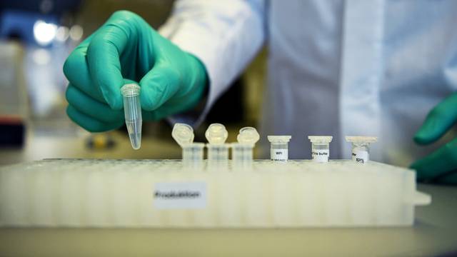 FILE PHOTO: Employee Philipp Hoffmann, of German biopharmaceutical company CureVac, demonstrates research workflow on a vaccine for the coronavirus (COVID-19) disease at a laboratory in Tuebingen