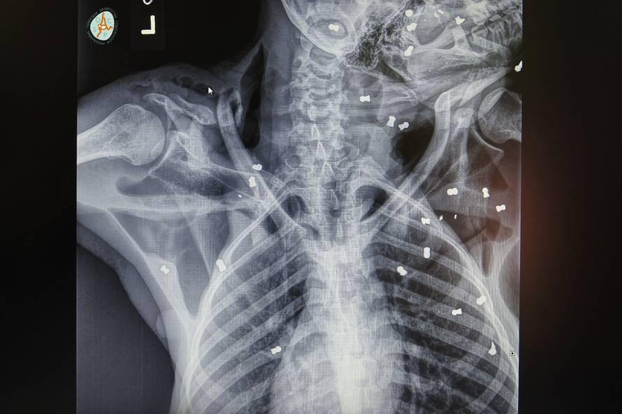 Stravična sudbina orangutana: Upucali ga iz zračnice 74 puta