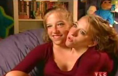 Sijamske blizanke Abby i Brittany navršile 16-tu