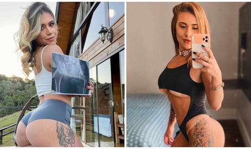 Brazilska manekenka ponosno pokazala rendgenski snimak svoje pozadine: Prirodna je!