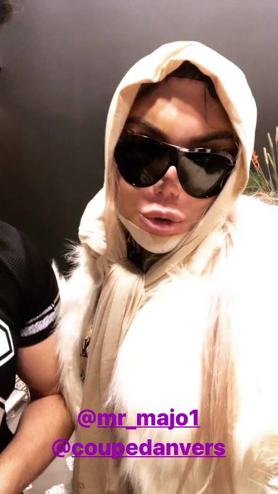 Ljudski Ken opet išao pod nož: Sad ne mogu govoriti ni gledati