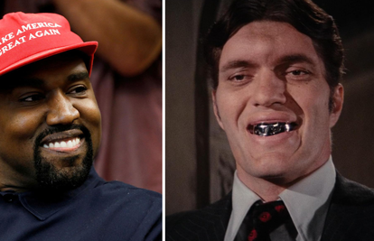 Kanye West uklonio zube te ih zamijenio protezom od titana