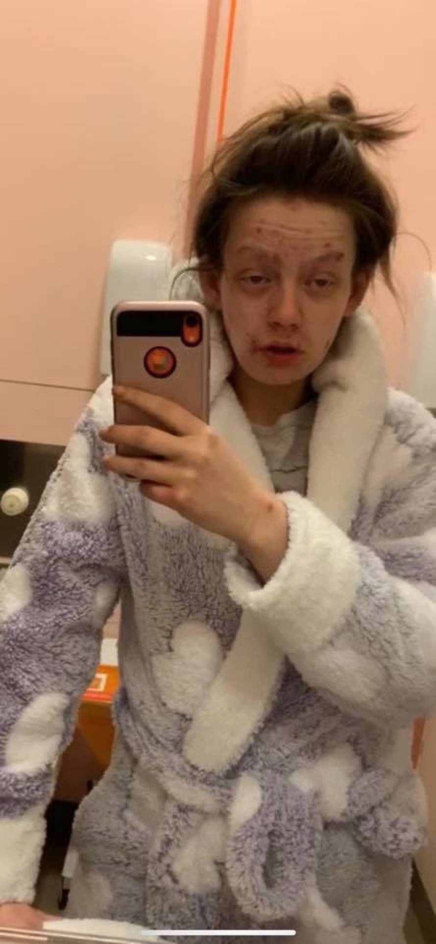 Bivša ovisnica o heroinu i majka dvoje djece pokazala kako sada izgleda: Naudila sam kćerkici...