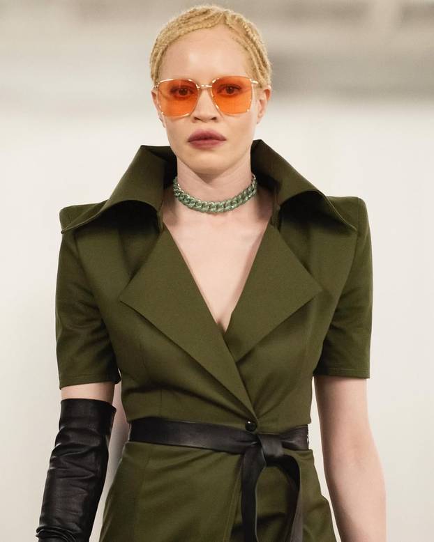 FOTO Afrikanka s albinizmom osvaja modnu industriju: 'Često privlačim znatiželjne poglede'