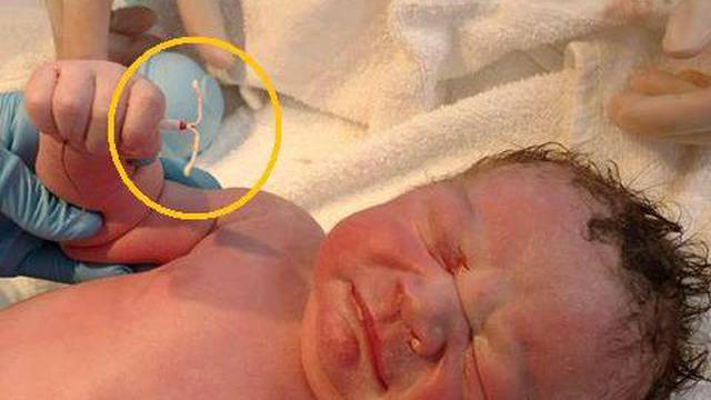 Zeznuo ih sve: Beba u ruci drži maminu spiralu protiv začeća