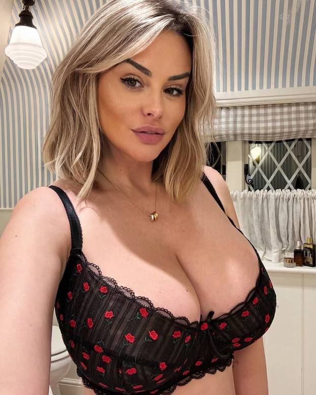 FOTO Poznata manekenka otišla na operaciju smanjenja grudi: 'Najbolja odluka u mom životu!'