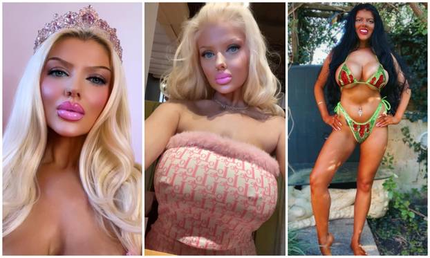 FOTO Britanska Barbie: Uložila sam više od 9000 € u izgled i operacije da izgledam mlađe!
