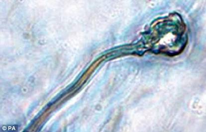 Lezbijke traže alimentaciju za četiri god. od donora sperme 