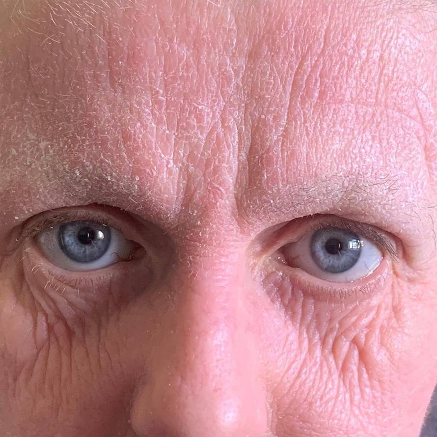 'Lice mi izgleda 20 g. starije, prestala sam uzimati steroide'