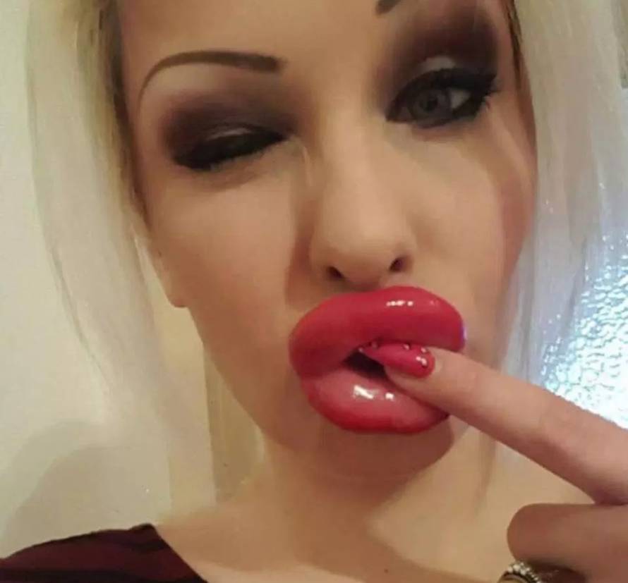 Pretjerale su s filerima: Zovu ih 'jeftinim porno glumicama'