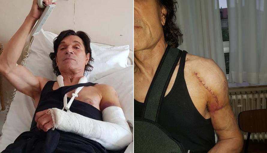 Jasminu Stavrosu su liječnici operirali lijevu ruku 90 minuta