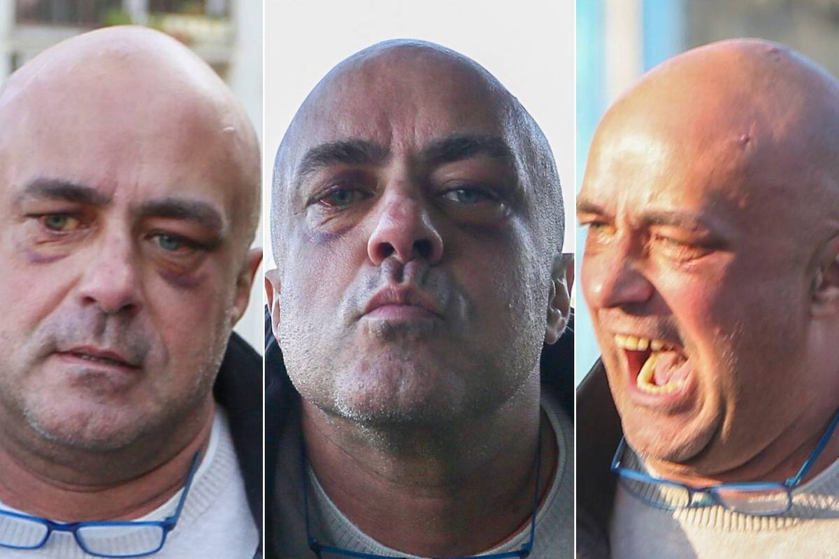 Tri lica Leona: Masnice ispod oba oka, divljao je i u bolnici