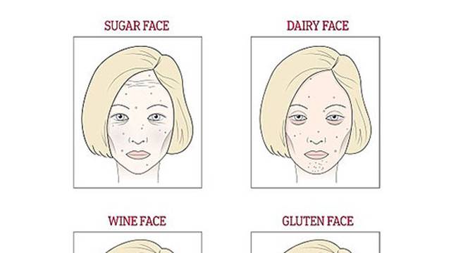 Lice otkriva što vam smeta - šećer, vino, mlijeko ili gluten?