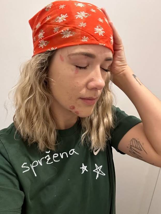 FOTO Debela Barbara: Hrvatska influencerica koja je bez filtera osvojila 100 tisuća pratitelja