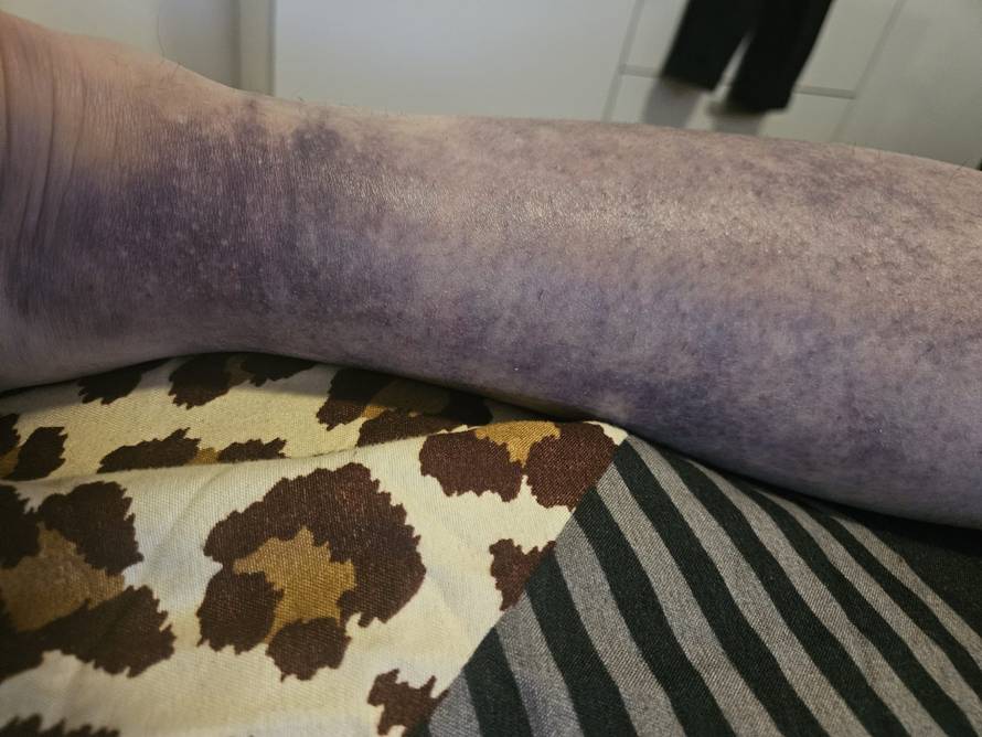 Super Silva za 24sata: Znam tko me napao, bilo je iznenada i s leđa. Jedna noga mi je uništena