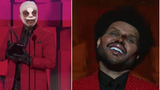 The Weeknd šokirao gledatelje transformacijom lica: 'Užas...'