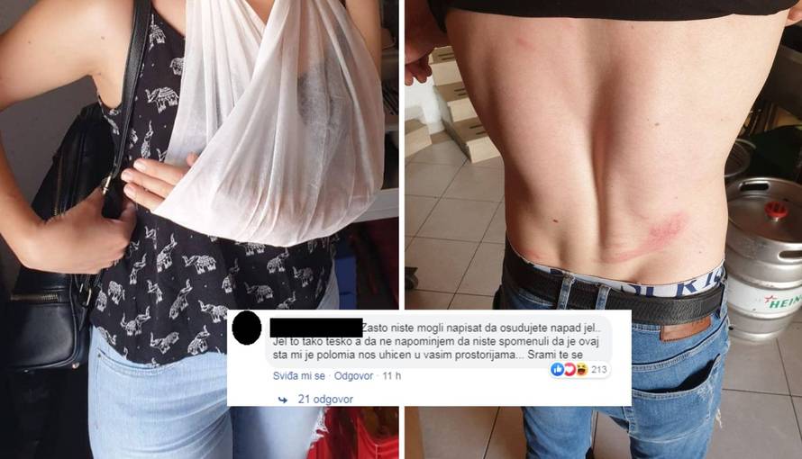 Slomljeni nos vatrogasca (26) ipak je teška tjelesna ozljeda