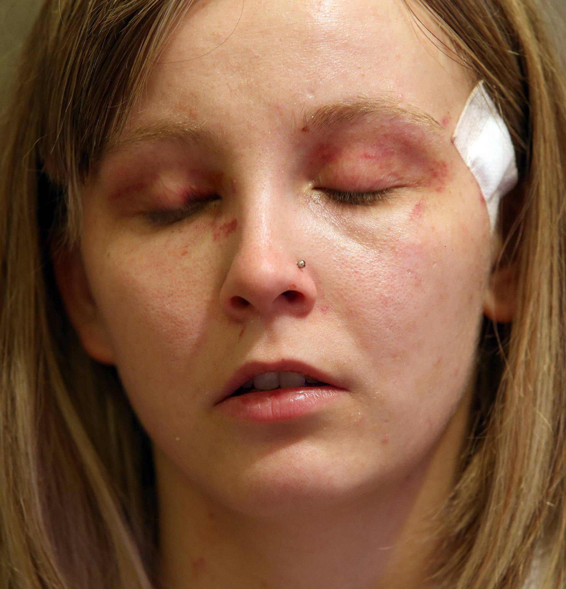 Sestre žrtve napada: 'Mislila sam da će mi iskopati oko'