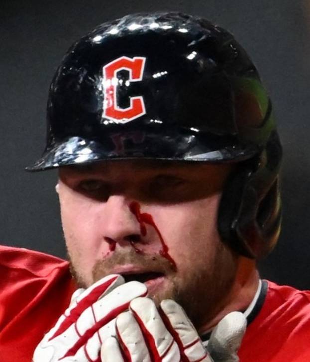 Ovako izgleda lice čovjeka kad ga pogodi loptica sa 160 km/h