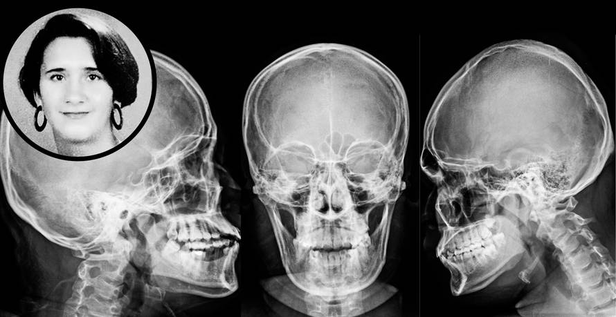 Ubojica je nosio rukavice: Svi udarci koji su ubili Jasminu