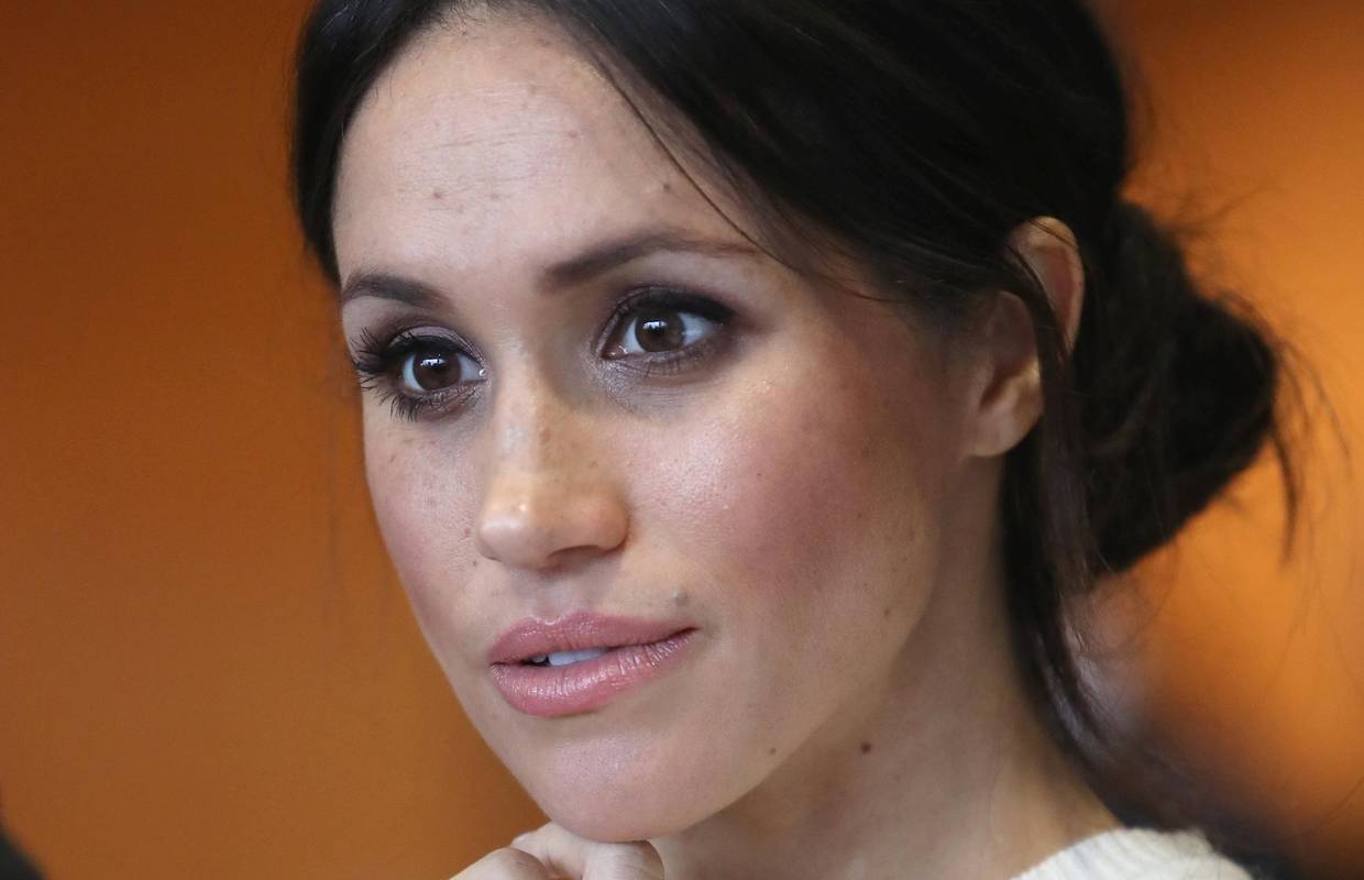 Novi trend: Tetoviraju pjegice da bi izgledali poput Meghan