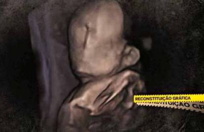 U Portugalu se rodila beba bez lica, ginekolog pod istragom...