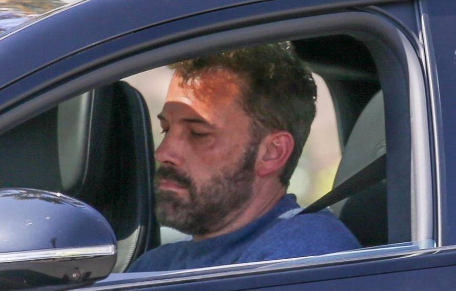 Ben Affleck nakon zahtjeva za razvod skinuo vjenčani prsten