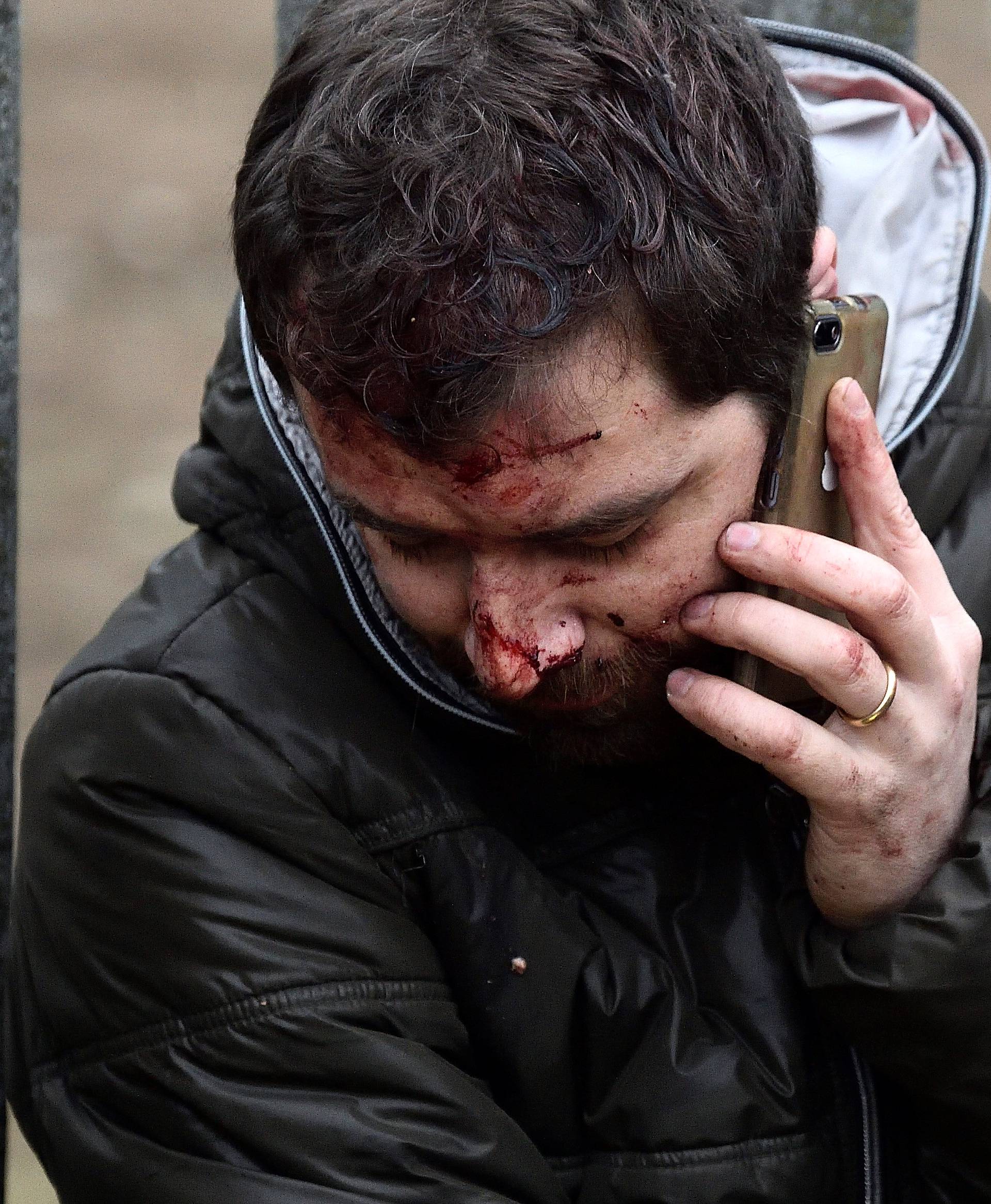 An injured person makes a phone call after two trains derailed in Pioltello, on the outskirts of Milan