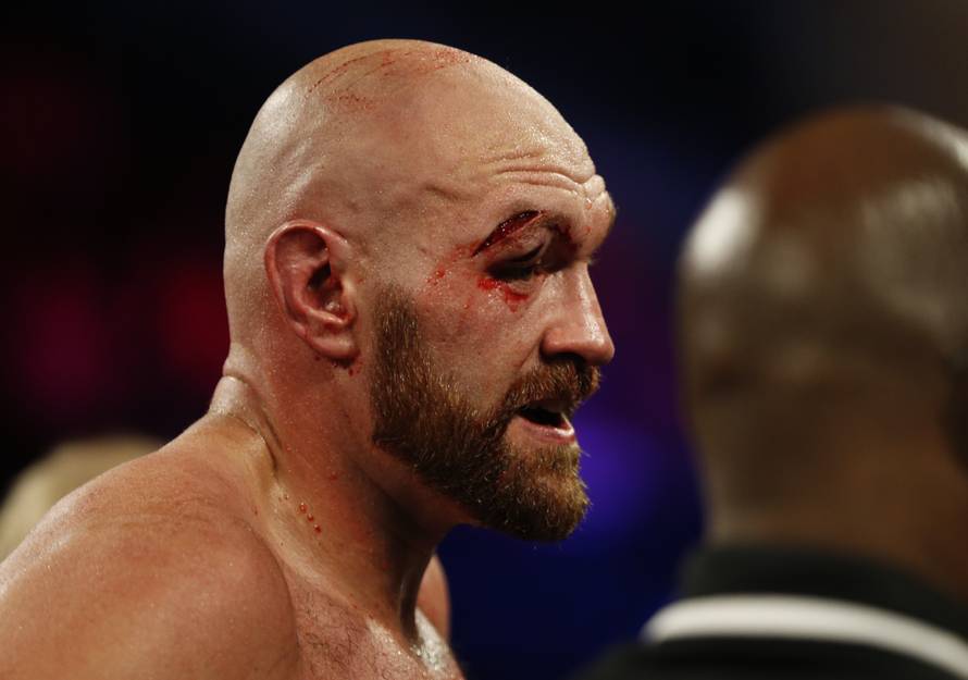 Tyson Fury v Otto Wallin