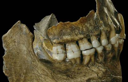 Neandertalci su 'otkrili' aspirin davno prije nas i liječili bolove