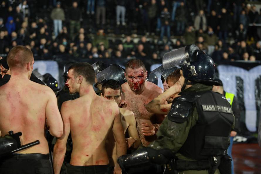 Police escort the soccer fans injured during the fights at a match between Red Star and Partizan in Belgrade