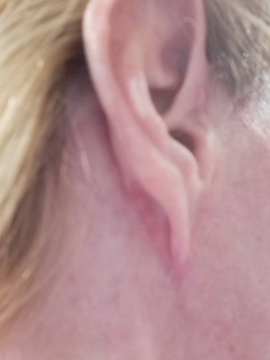 Estetski kirurg iz Zagreba htio ušutkati žene koje su se žalile na njega, stigla mu opomena!