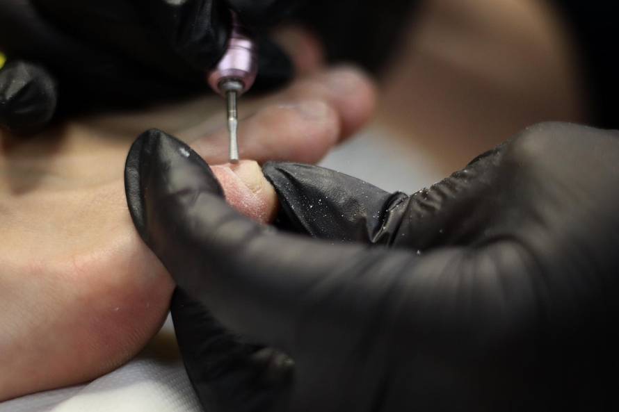 Kako spriječiti gljivice, urastanje noktiju i zadebljanja kože redovnim tretmanima?