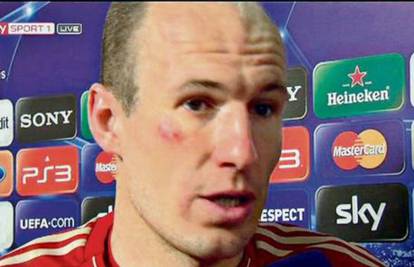 Francku Riberyju 50.000 eura kazne zbog udaranja Robbena
