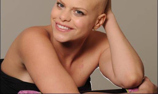 Jade Goody shrvana jer se rak širi na jetra i bubrege