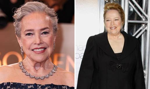 FOTO 'Ozempic vrat' ve&cacute; imaju mnogi slavni: Kreme ne poma&zcaron;u