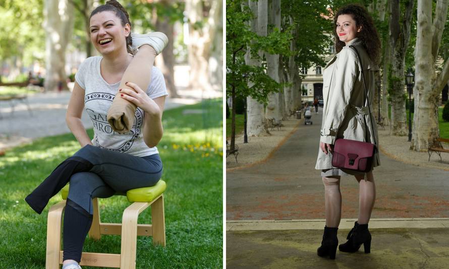 Anja nije odustala: 'Iako su mi amputirali nogu, nosim štikle'