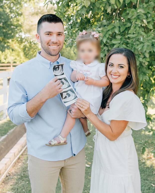 Ovako izgleda lice čovjeka kad ga pogodi loptica sa 160 km/h