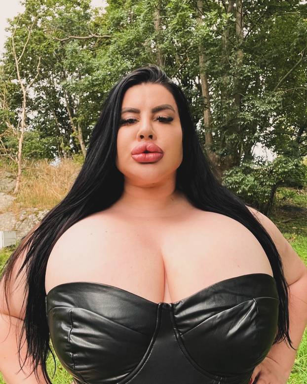 FOTO Stražnjica mi teži 45 kila, no već imam u planu sljedeću operaciju, želim imati najveću!