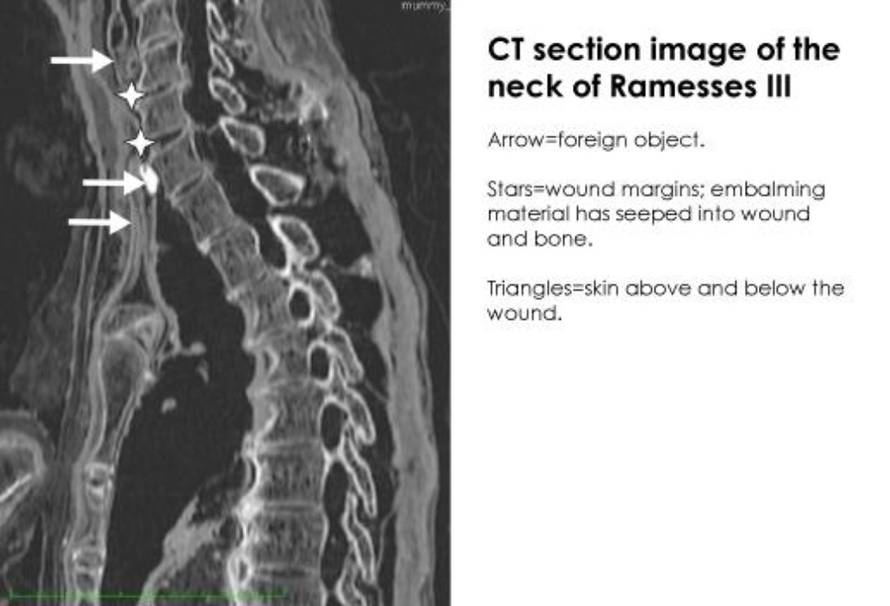 screenshot/British Medical Journal