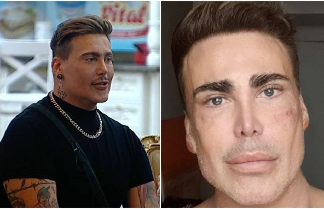 Cigi: 'Koža mi je dosta stradala u realityju pa sam se pomladio'