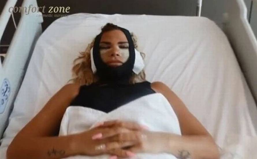 Starleta opet šokira: Cijela je u zavojima, smanjila je i grudi...