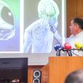 'Djetetu se zabila kost u mozak! Tu je 285% više hospitaliziranih u nesrećama s el. romobilima...'