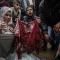 'Bolnica Al-Aqsa u Gazi izgleda kao mjesto potpunog pokolja, ljudi umiru čekajući na pomoć'