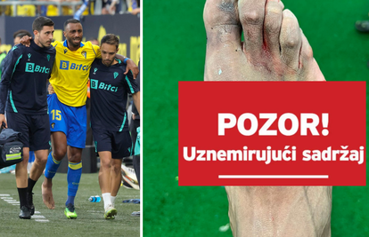 Hazard protivniku slomio dvije kosti u stopalu: Dobio samo žuti