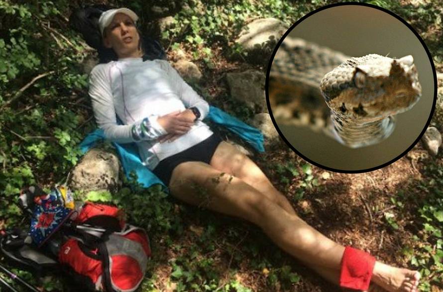 'Čula sam siktanje...otrov mi je oštetio tkivo, stalno me boli...'