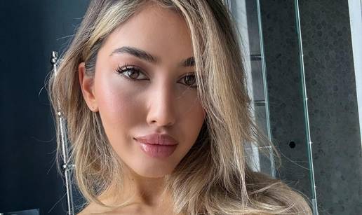 FOTO Sve joj je na mjestu! Prije su je ismijavali, danas zara&dstrok;uje ogromne cifre kao model